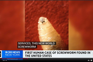 CBS New York: First Human Case of Screwworm
